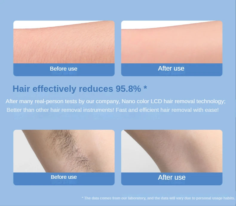 Painless Epilator Physical Crystal Hair Removal Body Depilation Tool Man Women's Hair Removal Beauty Tool Sanding Artifact