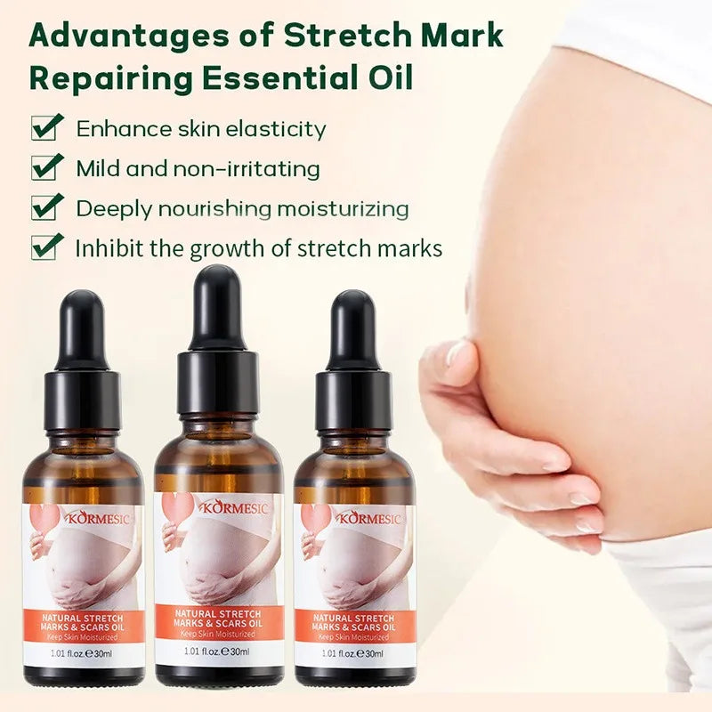 Stretch Marks Remover Essential Oil Pregnancy Maternity Body New Old Stretch Mark Removal Serum Increase Elasticity of Skin Care