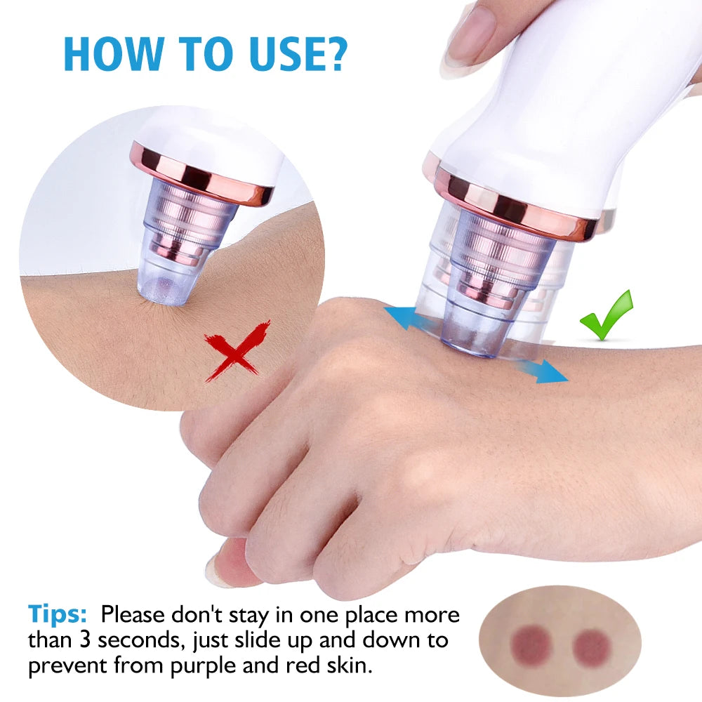 Electric Vacuum Blackhead Removal Facial Cleansing Black Spots Suction Acne Pimple Remover Beauty Instrument Skincare Tools
