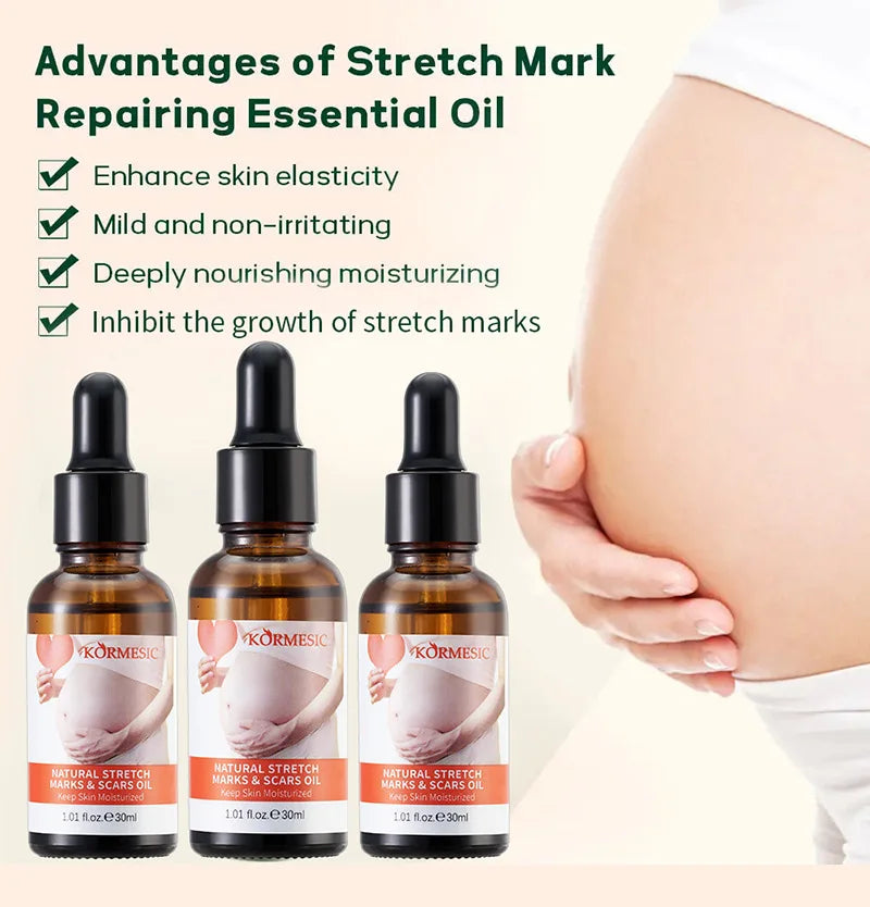 Stretch Marks Remover Essential Oil Pregnancy Maternity Body New Old Stretch Mark Removal Serum Increase Elasticity of Skin Care