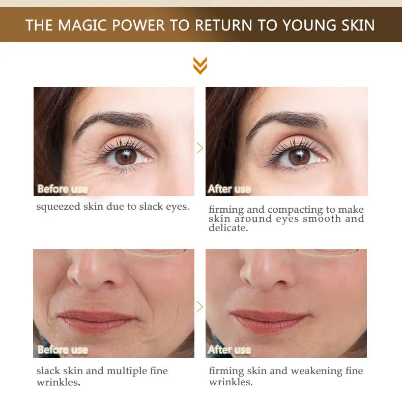 ARTISCARE Peptide Anti Wrinkle Facial Cream Whitening Lifting Day Cream Skin Care Anti Aging Acne Treatment Firming Face Cream