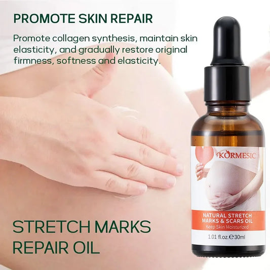 Stretch Marks Remover Essential Oil Pregnancy Maternity Body New Old Stretch Mark Removal Serum Increase Elasticity of Skin Care