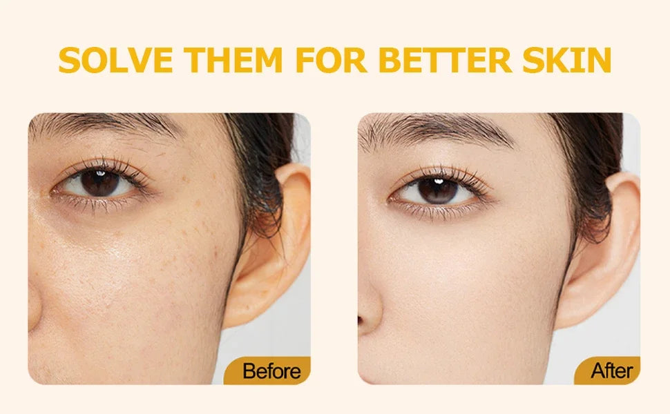 Deep Vitamin C Golden Capsule Face Moisturizer Liposome Capsules For Wrinkles Skin Radiance Glow Hydration Lightweight Skin Care
