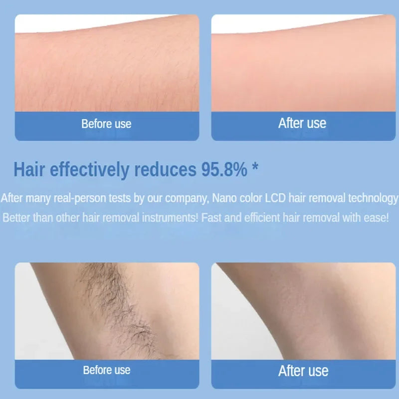 Painless Epilator Physical Crystal Hair Removal Body Depilation Tool Man Women's Hair Removal Beauty Tool Sanding Artifact